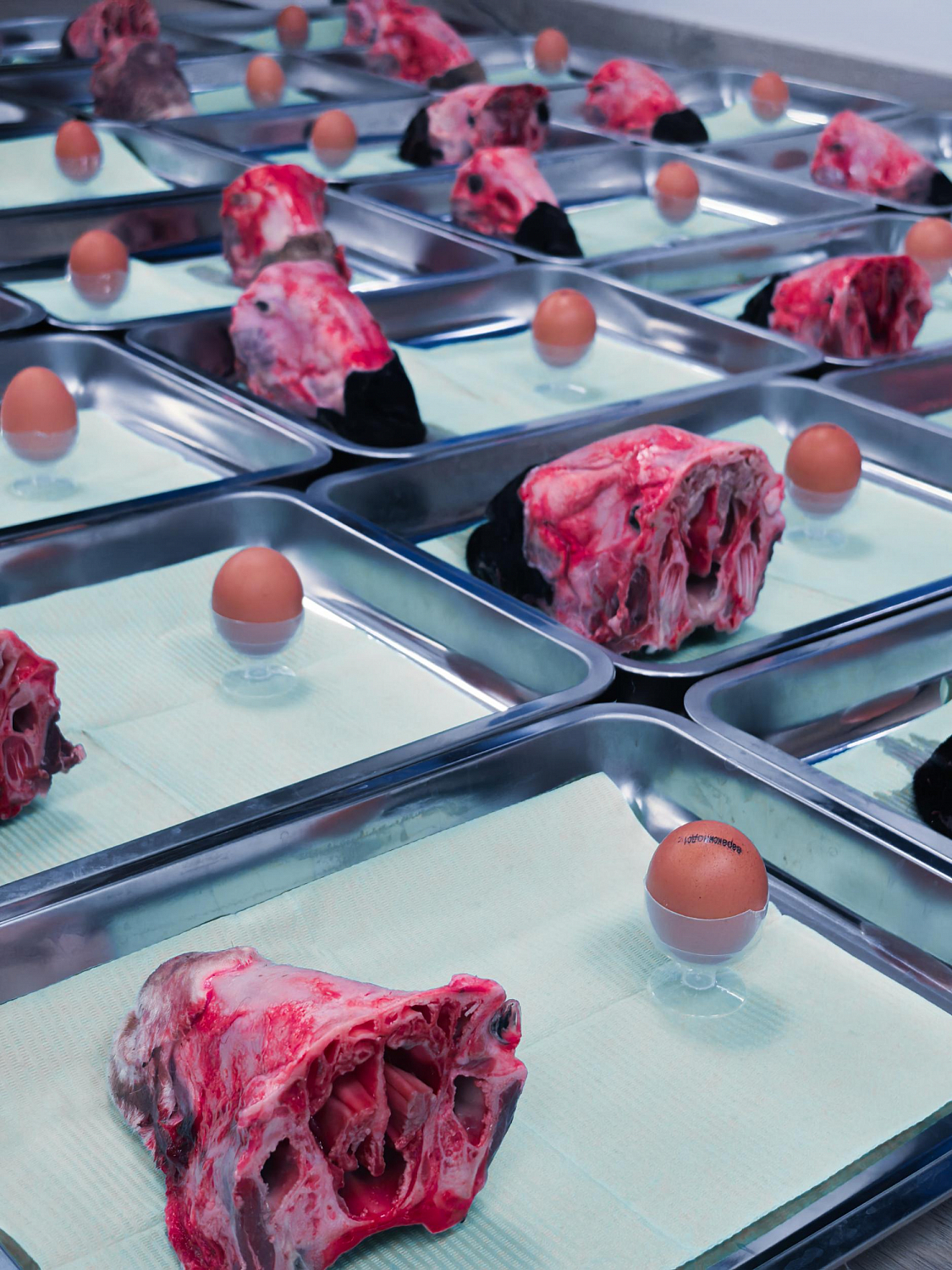 Два дня глубокой практики по костной пластике и синус-лифтингу