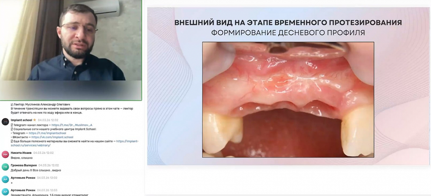 Ламинатная техника и НКР: как выбрать методику костной пластики под конкретного пациента