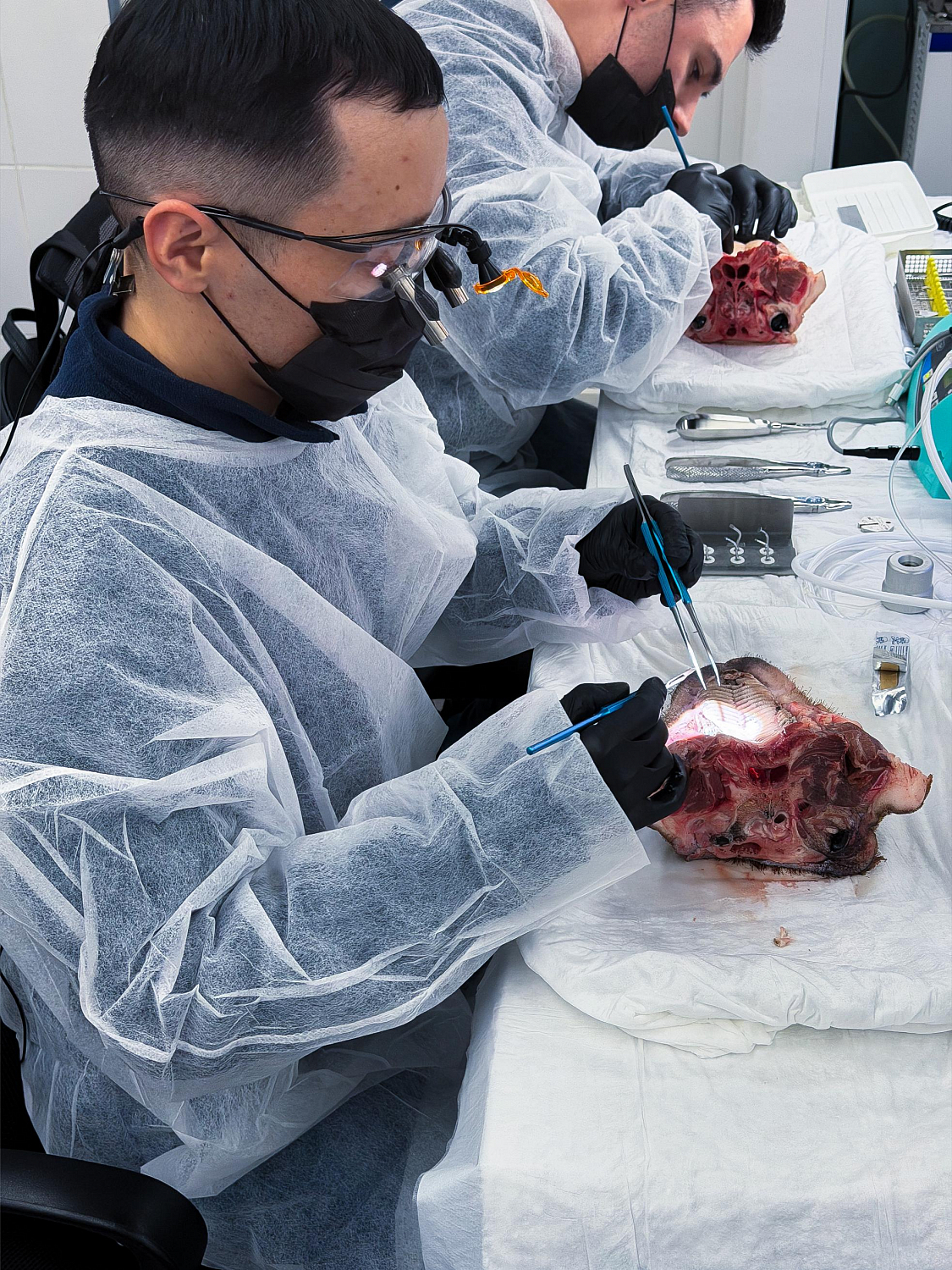 Удалить зуб и сохранить лунку: как проходит малотравматичная хирургия  