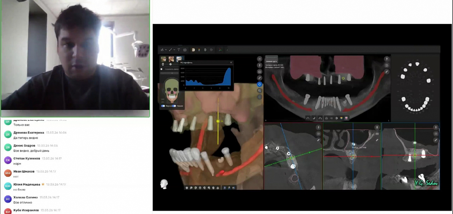 Демонстрация в реальном времени: цифровое планирование имплантации на этапе создания хирургических шаблонов