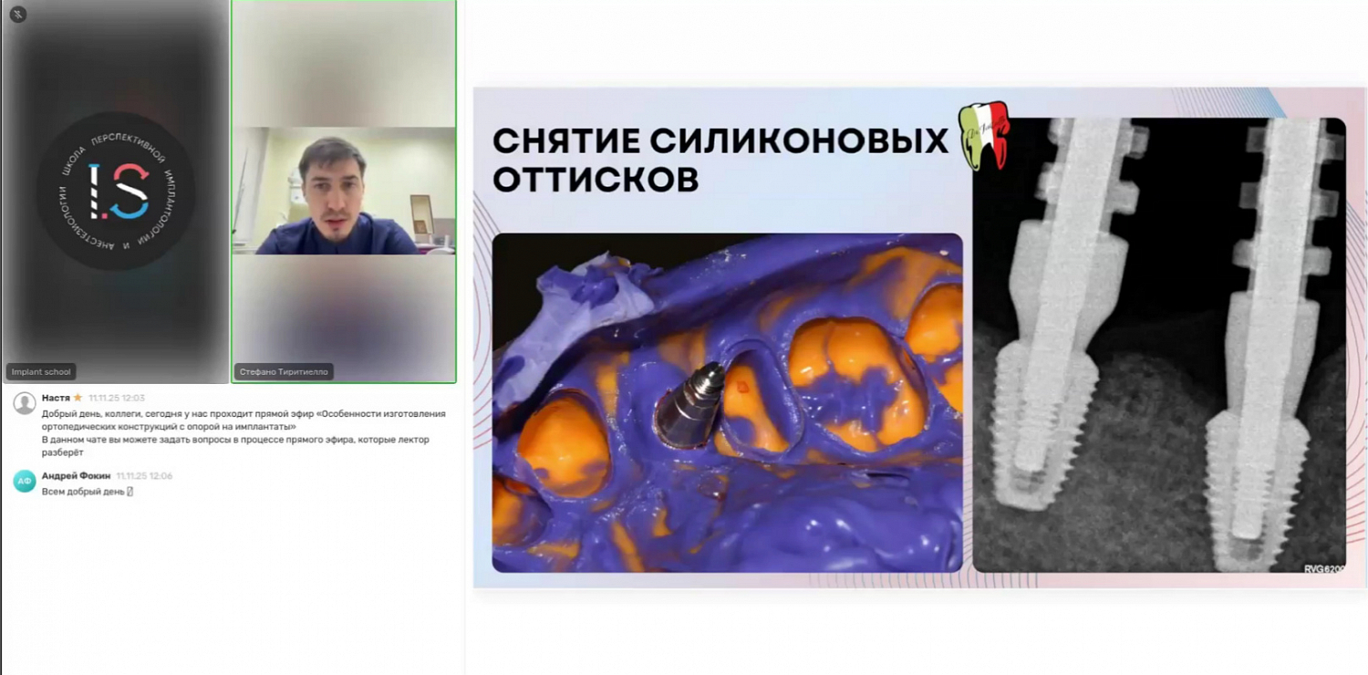 Особенности изготовления ортопедических конструкций с опорой на имплантаты